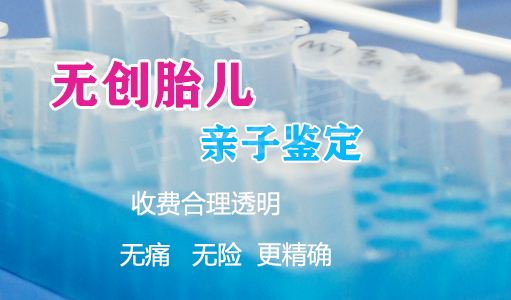 巴中怀孕如何做血缘检测,巴中孕期做亲子鉴定具体流程 巴中怀孕如何做血缘检测,巴中孕期做亲子鉴定具体流程